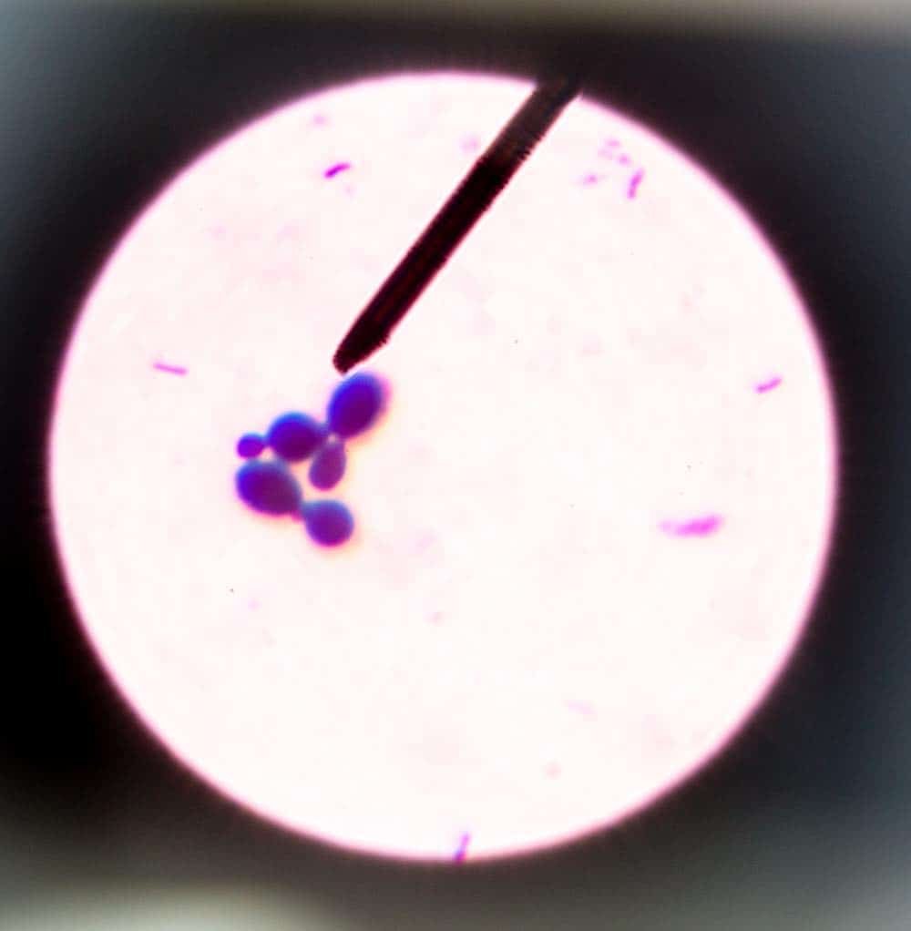 budding yeast cells shown under a microscope